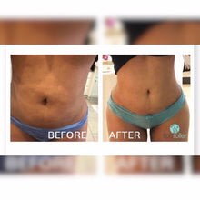 The Original LipoRoller®